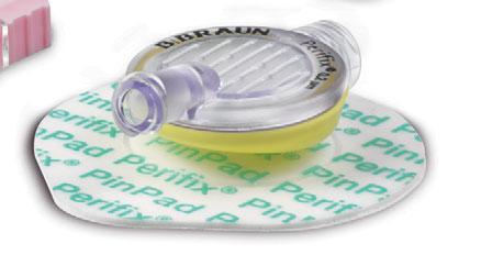 EPIDURÁLIS ANESZTÉZIA AZ INNOVATÍV SZETT PERIFIX LOSS-OF-RESISTANCE