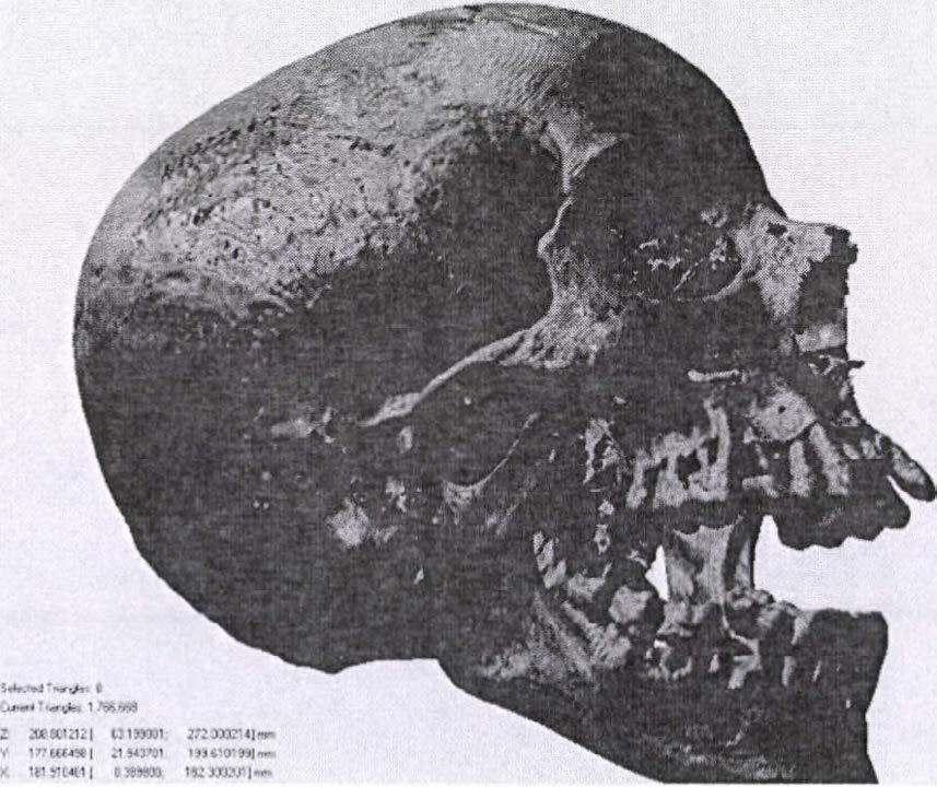 A paleo-mikrobiológiai vizsgálatokat, melyek során bakteriális DNS jelenlétét kerestük a mumifikálódott szövetekben, a University College London munkatársaival együttműködésben végeztük el (Fletcher