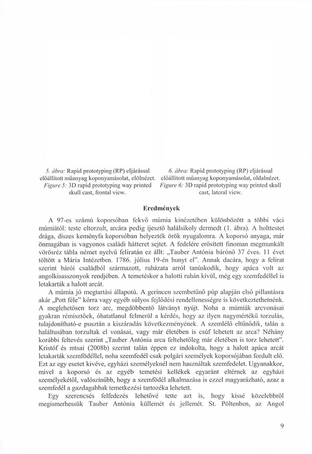 5. ábra: Rapid prototyping (RP) eljárással 6. ábra: Rapid prototyping (RP) eljárással előállított műanyag koponyamásolat, elölnézet. előállított műanyag koponyamásolat, oldalnézet.