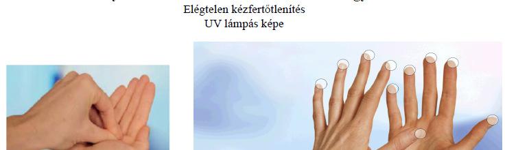KRITIKUS TERÜLETEK, MELYEKRE FOKOZOTTAN ÜGYELNI KELL Klinikailag