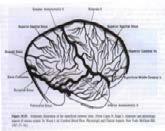 The International Study On Cerebral Vein and Dural Sinus Thrombosis (ISCVT) Prognosis of