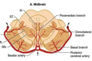 agyban : ISCHEMIÁS STROKE +/- az agytörzsben : OCULARIS STROKE: Szemmozgató