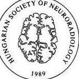 OCULARIS STROKE konszenzus (amaurosis