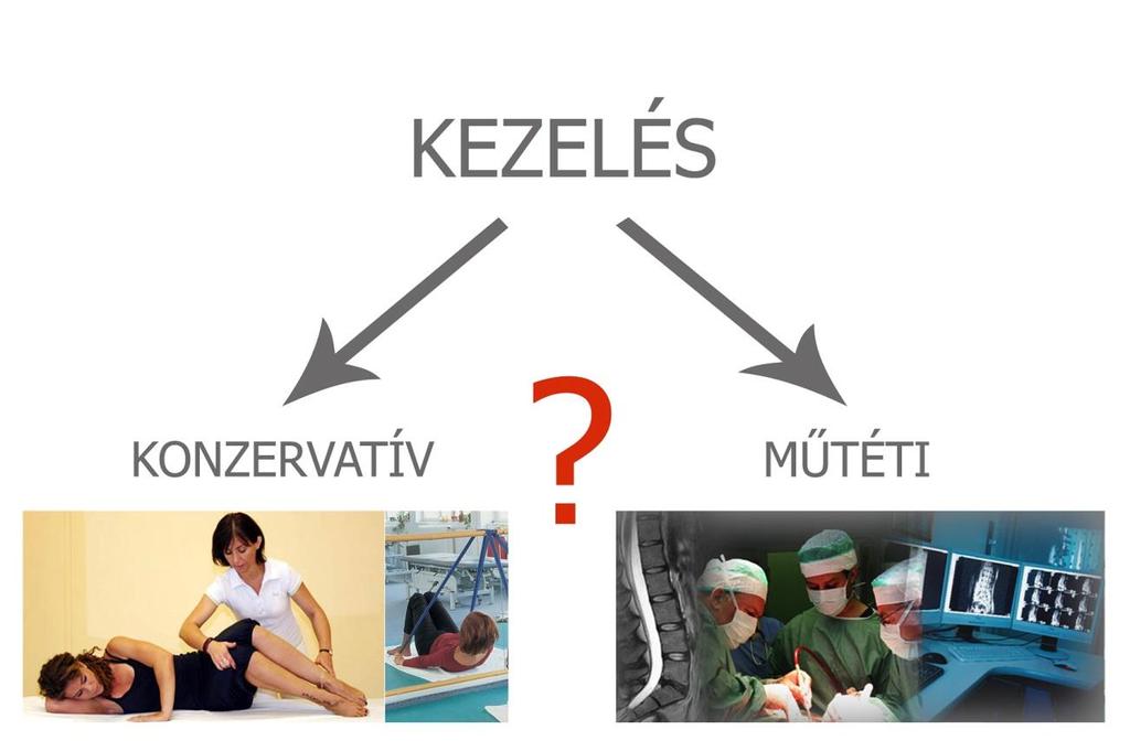 Milyen kezelési lehetőségek vannak? Alapvetően kétféle kezelési lehetőség áll rendelkezésre: 1.