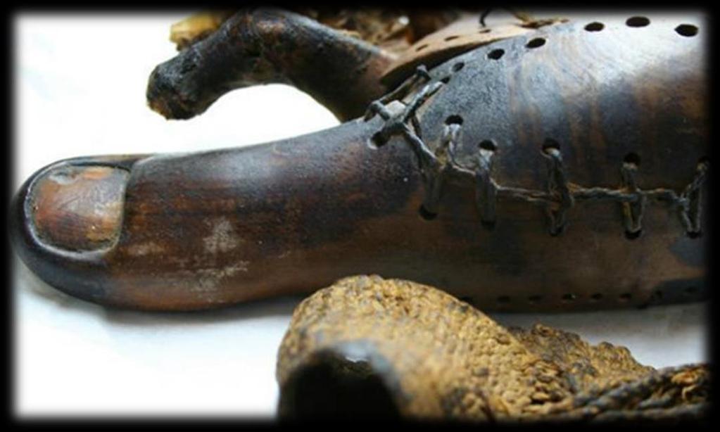 Egy kis történelem Egyiptomi lábujj lehet a világ első protézise Magas rangú egyiptomi pap lányának