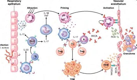 Az AAV pathomechanizmusa Neutrophil APC Infekció APC IL-23 termelés Th17 légúti epithel CXC termelés Neu migráció MΦ IL-1β, TNF termelés priming (PR3 expresszió), Treg elégtelenség B aktiváció, ANCA
