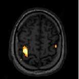 mérési idő ASL arterial spin