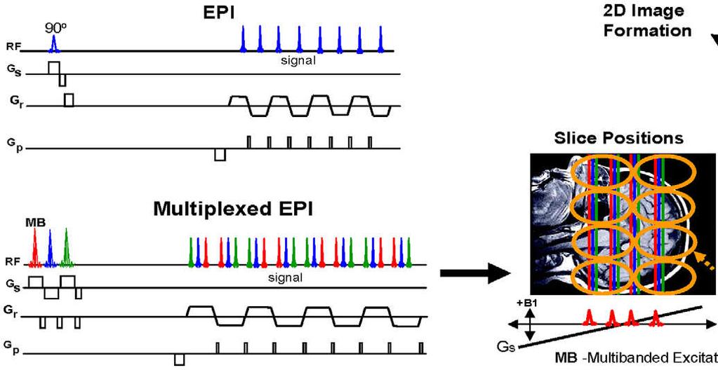 Simultaneous Multislice (SMS) EPI David A. Feinberg et al.