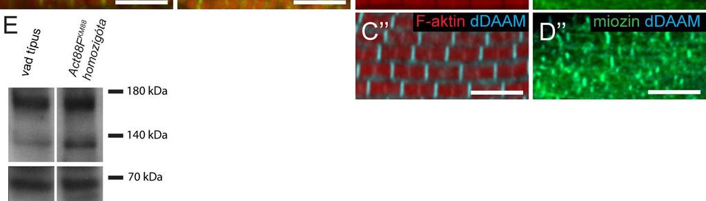 (A-A ) Az mhc 1 /+ legyek IFM-jeiben a szarkomer hossz csökkenés elérte a ~22%-ot, és a Z-korongok struktúrája is részben érintett.