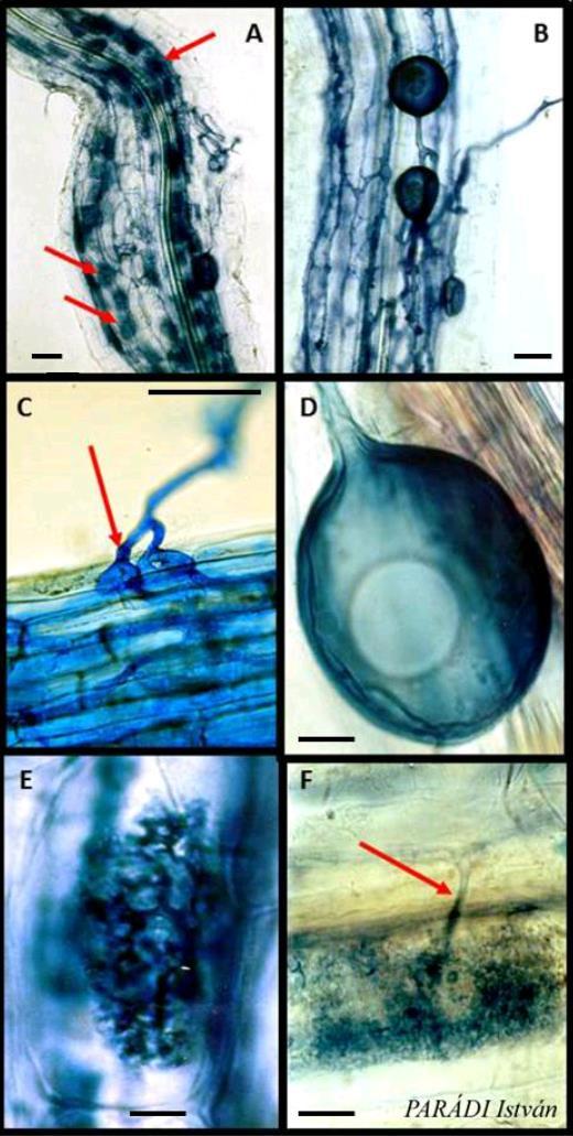 egyes baktérium és gombafajok képesek szerves savképzésük által a szervetlen foszfor forma felszabadítására szervetlen foszfátok oldatba vitele arbuszkuláris mikorrhiza