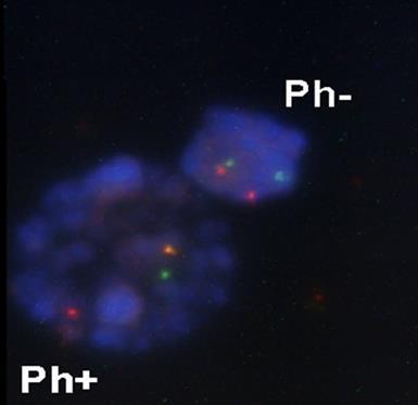 Alkalmazás: strukturális eltérések