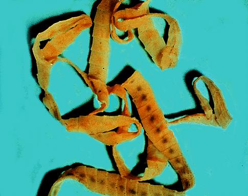 Többsejtes paraziták (helminths)