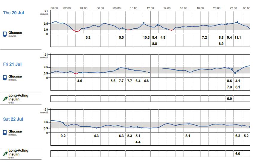 CGM-vizsgálat 2. ábra július végi 3 nap görbéi en.