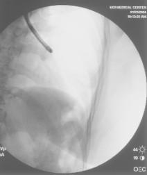 Lateralis basalis S9 Posterior