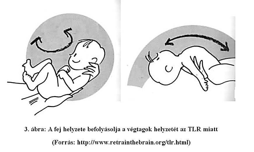 3. ábra: A fej helyzete befolyásolja a végtagok helyzetét a TLR miatt (Forrás: http://www.retrainthebrain.org/tlr.html) 3.