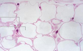 adipocyták (fehér zsírszövet)