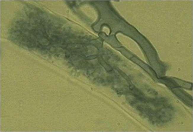 Paraziták A parazita gombák a gazdaszervezettől vonják el a szerves anyagokat.