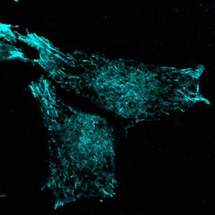 A Stim1 targetálása különböző plazma membrán