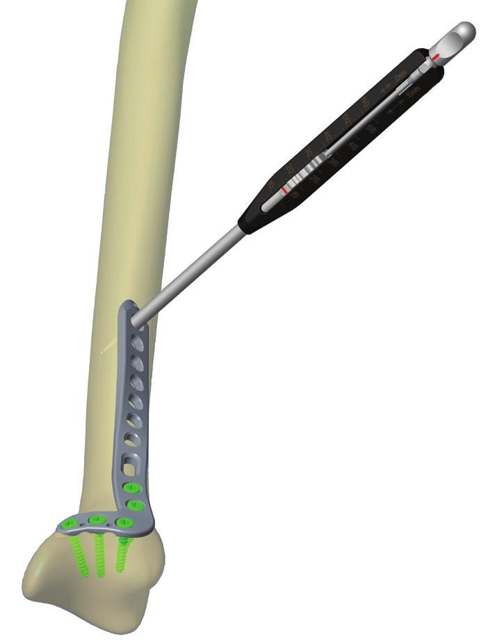 a 2.8 mm-es fúróval.