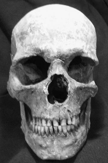 3. ábra: 275/287 adultus korú férfi. Fig. 3: 275/287 male from adultus age group. 4.