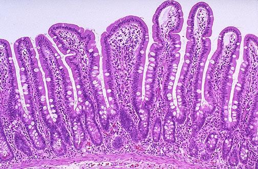 A. Un număr mare de peptide, produse de celulele corpusculilor Hassal B. Melatonină (amină) și vasotocină (polipeptid) C. Catecolamine, în urma stimulării neuronilor din ganglionul celiac D.