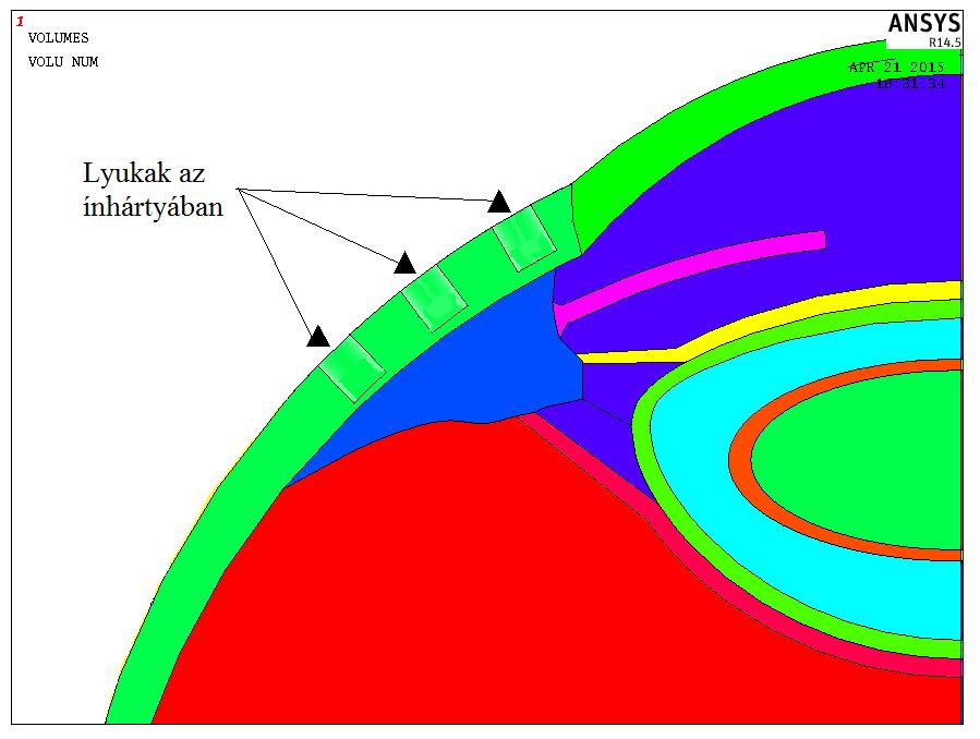 módosításokra azért volt szükség, mert ennél a vizsgálatnál a szemgolyó külső burkának geometriáját globálisan módosítottam (lyukak), ami az eredmények alakulását jobban befolyásolhatja, mint a