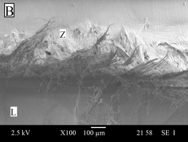 ) származó átlagos vastagság egy kicsit nagyobbra adódott: 43,2±9,6 µm. Az utolsó metódussal (OM2.