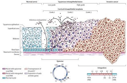 gov/std/hpv/commonclinicians/clinicianbro.txt HPV fertőzés II.