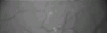 IVM video: