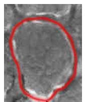 Alveolus terület Alveoláris terület (µm 2 ) 1100 1000