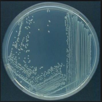 Pseudomonas sp. A Pseudomonas sp.