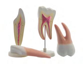 belső patológiás elváltozásokat: gingivitisz, pulpitisz, apikális parodontitisz, káriesz, fognyaki káriesz, fogkő. Méret: 6 x 4,5 x 10,5 cm.