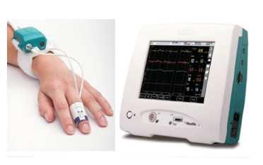 BMEYE monitor series Nexfin monitor Edwards Lifesciences Corporation