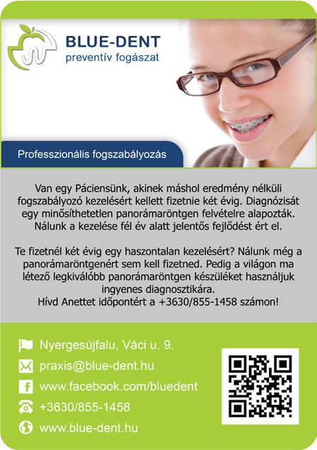 06-20/931-31-52 E-mail: vikioptika@gmail.com Web: www.vikioptika.hu 06-30-294-1478 Akció részleteiről érdeklődjön üzleteinkben.