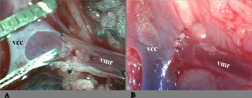 A vena cava caudalis elülső falán elliptikus venotomiát végeztünk (9. ábra F), melynek hossza megegyezett a vena mesenterica maximális átmérőjével.