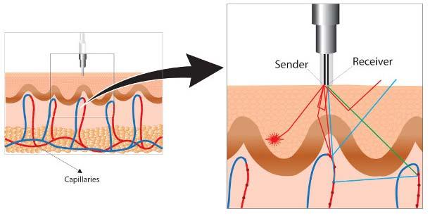 szög és az anastomosis alatt és felett mért érátmérőket. Az offline képelemzést az Adobe Photoshop CS5 software segítségével végeztük.