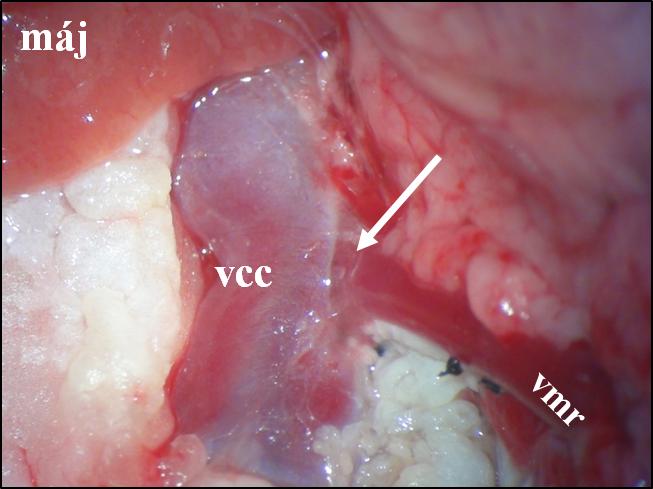 A shunt végleges geometriáját a vena mesenterica rostralis és vena cava caudalis közti távolságot figyelembe véve alakítottuk, hiszen fennállt a kockázata annak, hogy a vena mesenterica rostralis