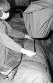 coagulátor zsinórját. Képerõsítõ alatt ellenõrizve szembetûnik a valgus-varus eltérés (10. ábra).