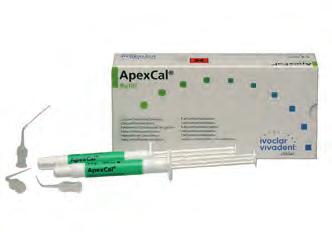 725 UltraCal XS (Ultradent) Az UltraCal XS 35% kálcium-hidroxid tartalmú paszta a gyökércsatorna ideiglenes lezárásához.