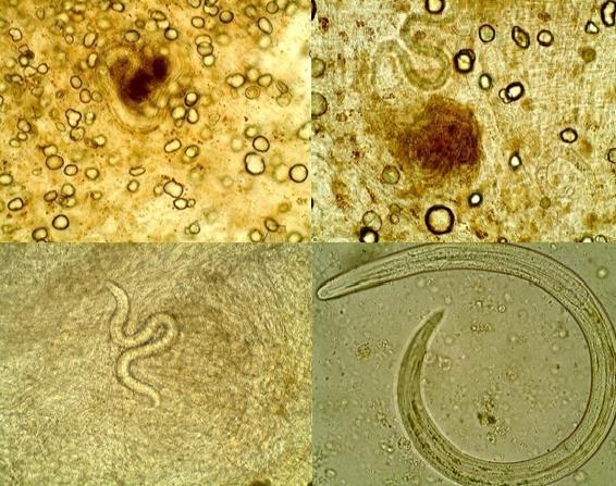 9. ábra: A. abstrusus tüdőféreglárvák Planorbella duryi csigában 5 hónappal a fertőzést követően, Dr. Majoros Gábor felvétele.