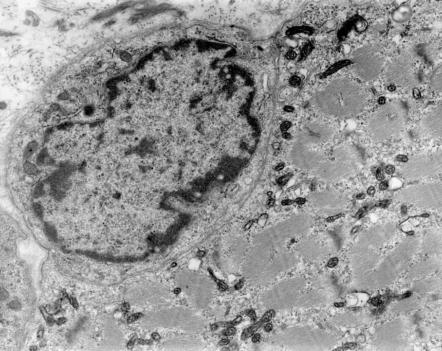 , őssejt tulajdonságú szatellita sejtek myoblast