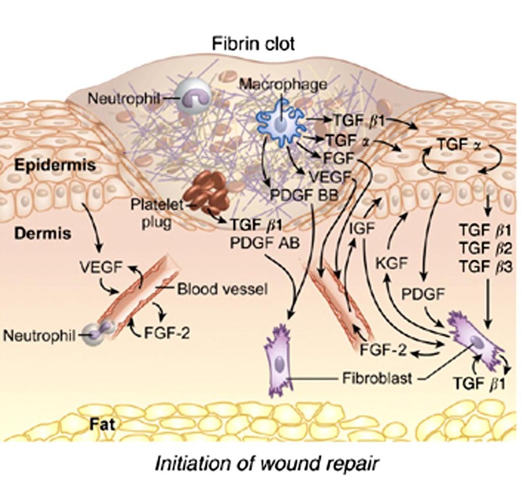 Sebgyógyulás növekedési faktorok Fibrin alvadék Fibroblast proliferáció migráció
