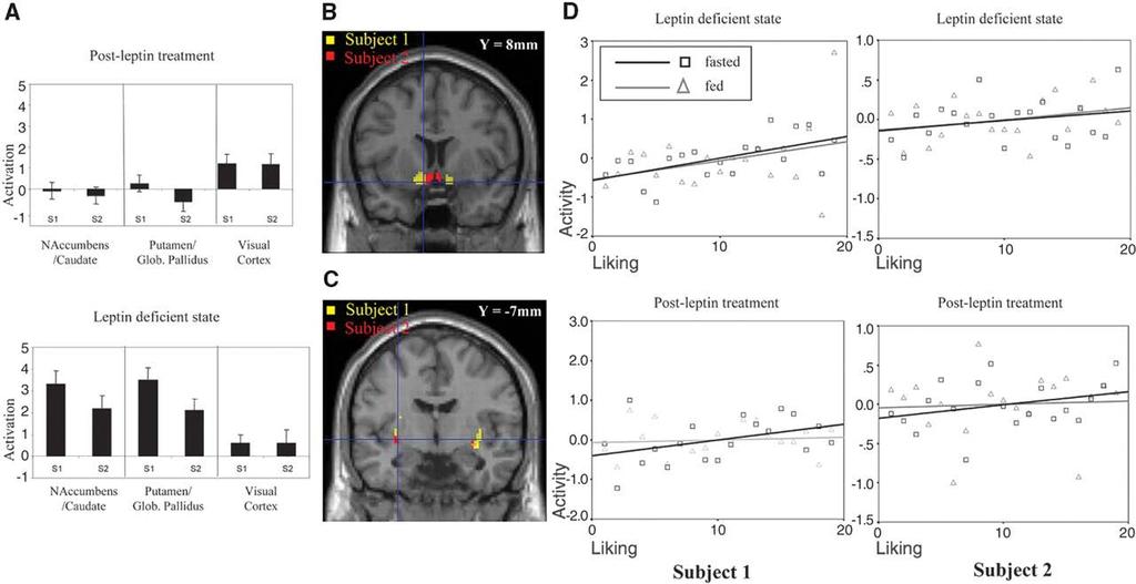 Leptin regulates brain responses to food images. I.