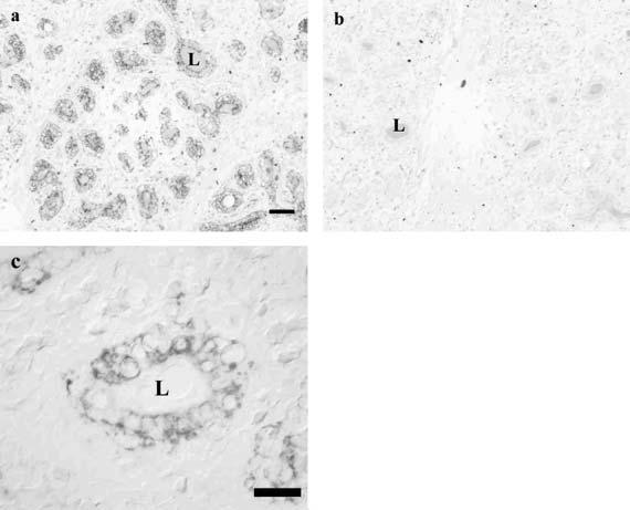 Bovine FcRn in the mammary gland 3 Fig. 1. In situ hybridization and immunohistochemistry on a non-lactating mammary gland section.