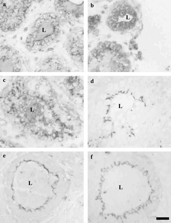 4 B Mayer and others Fig. 2. Immunohistochemical analyses of bovine mammary gland biopsies around parturition. Diffuse FcRn expression was detected 14 (a) and 7 (b) days prepartum in the acinar cells.