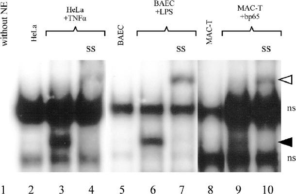 MAC-T (MAC-T+bp65). Nuclear extracts were incubated and run with labeled, consensus kb oligonucleotide in absence or presence of p65 antibody (ss).
