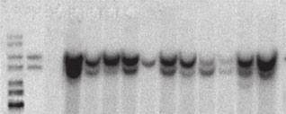 W. Lu et al. 6kb 5kb M P CK 14 13 11 5 19 33 28 9 2 1 6 Figure 1. Southern blot analysis of the genomic DNA digested by Nco I from 11 transgenic founders.