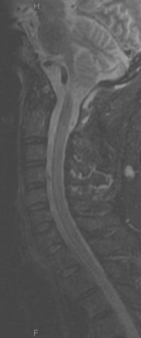 vena között fistula Praeoperatív