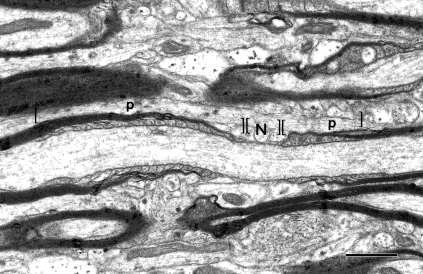 az oligodendroglia nyúlványa