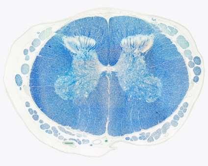 Luxor fast blue Myelinfestési módszer Nagy affinitással kötődik a myelin lipoprotein